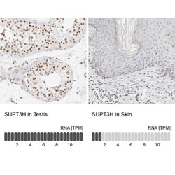 SPT3 Antibody, Novus Biologicals 0.1mL; Unlabeled:Antibodies, Polyclonal